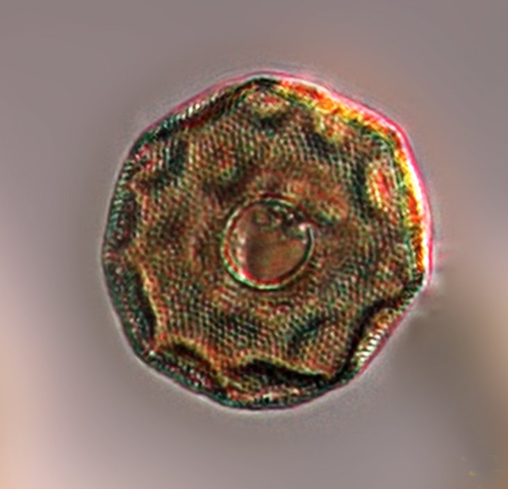 弯凸表壳虫Arcella_gibbo