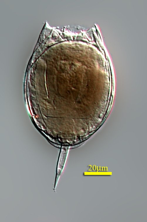 尖角单趾轮虫Monostyla ha
